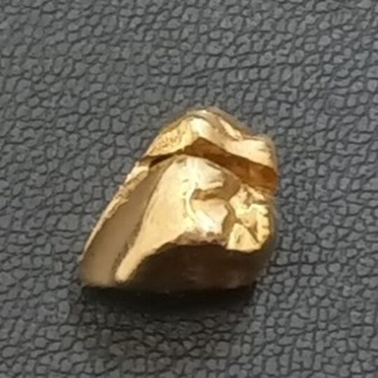 画像11104：金歯